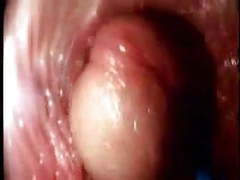 KiloPanties presents: Video from the inside of a vagina... very interesting